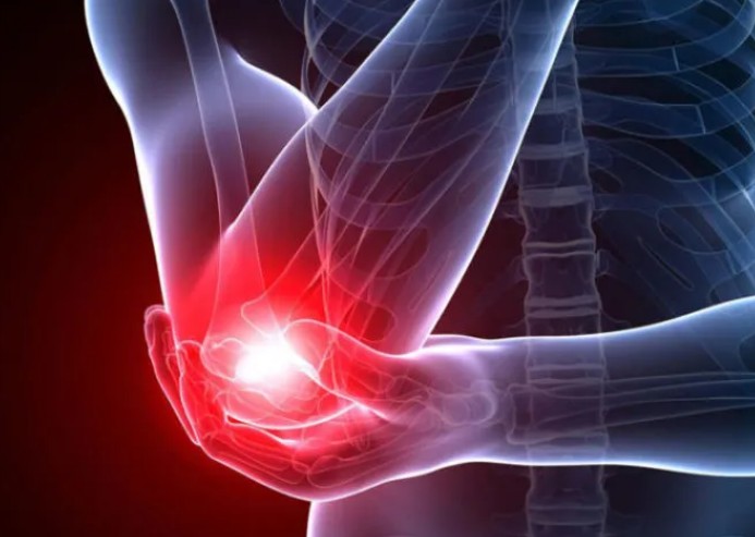 팔꿈치 통증과 원인 팔꿈치 관절염