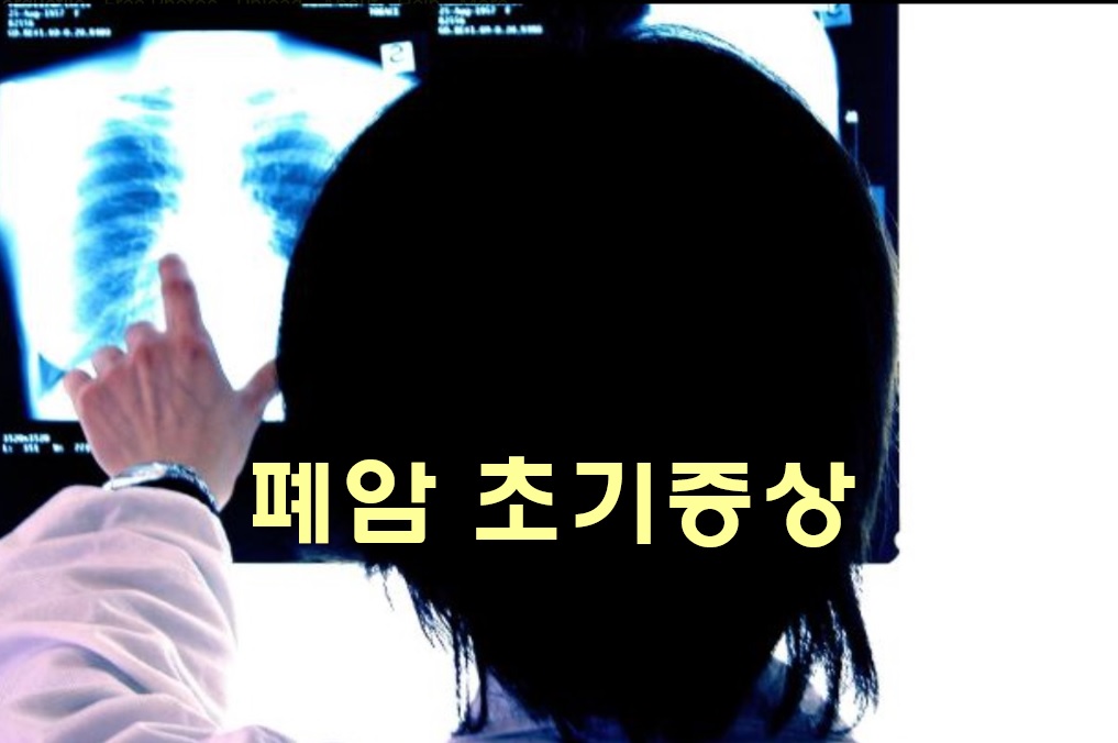  폐암 초기증상과 폐암 검사방법