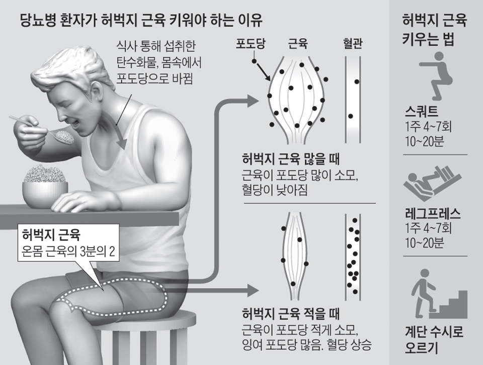  당뇨병 환자가 허벅지 근육을 키워야 하는 이유