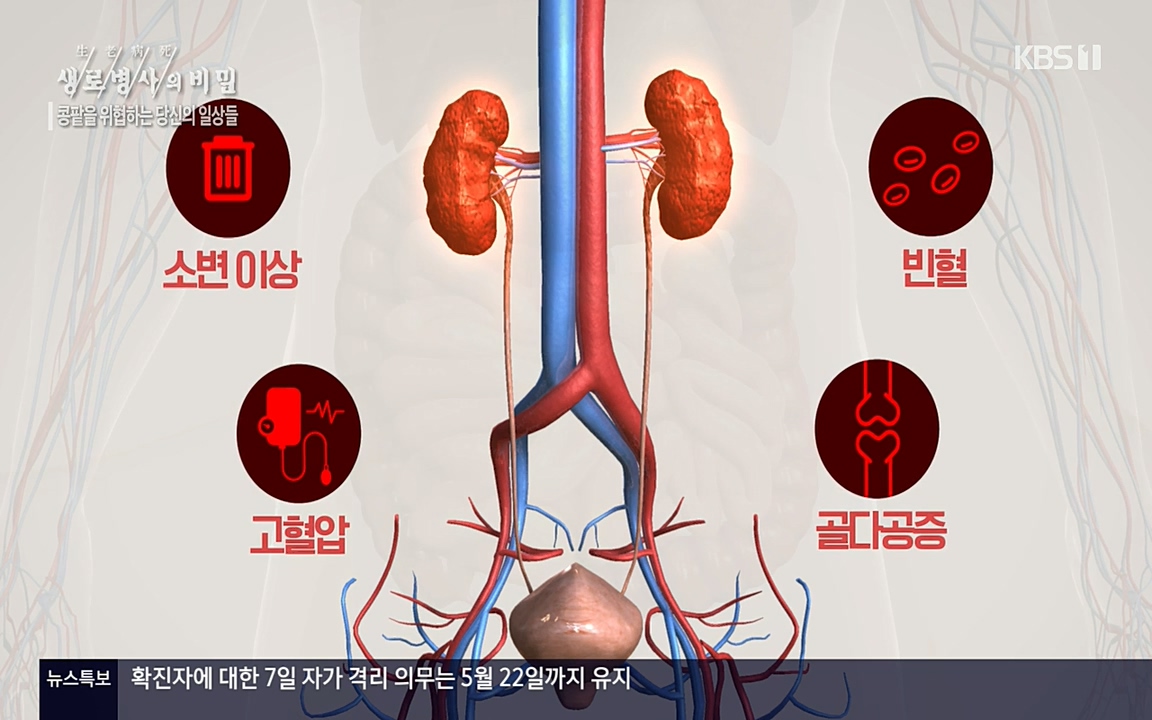 생로병사의 비밀.E819.220421p-NEXT.mp4_20220421_193533.006.jpg