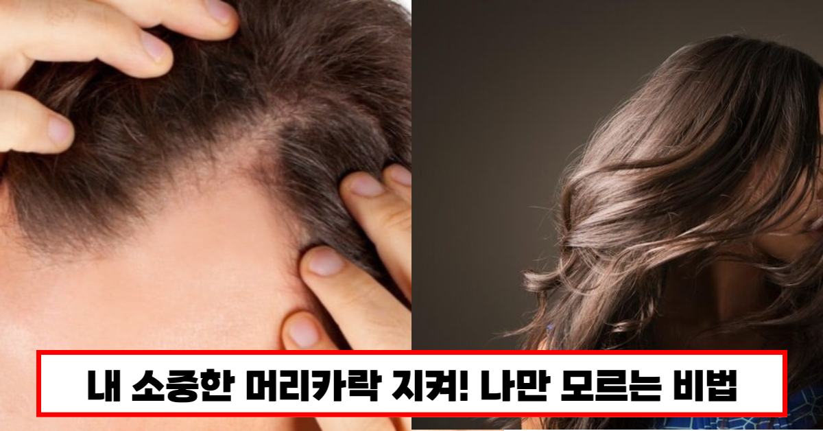 (속보) 소중한 나의 모발을 지켜주세요! 나만 모르는 비밀 탈모약 대신 OO 먹으면 머리가 굵어진다 1