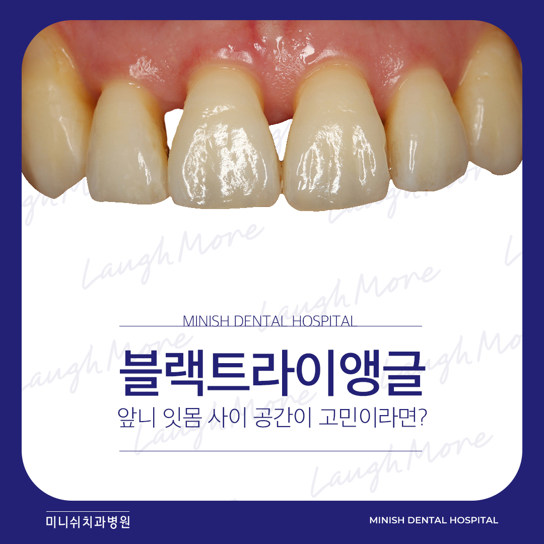 공간사이 이미지