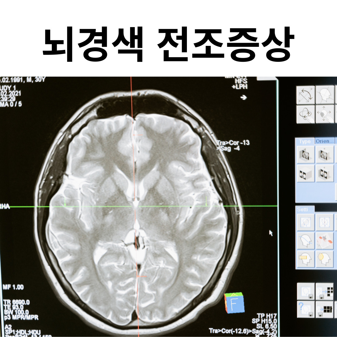 뇌경색 전조증상