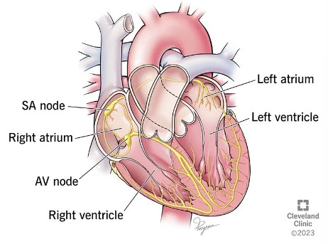 부정맥 Arrhythmia f. clevelandclinic