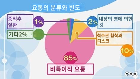  요통(허리)의 위험도 자체 점검. 원인이나 증상, 대처법·치료의 주의점에 대해 알아보자 (1)