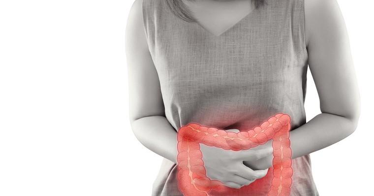  장폐색 원인 증상 치료