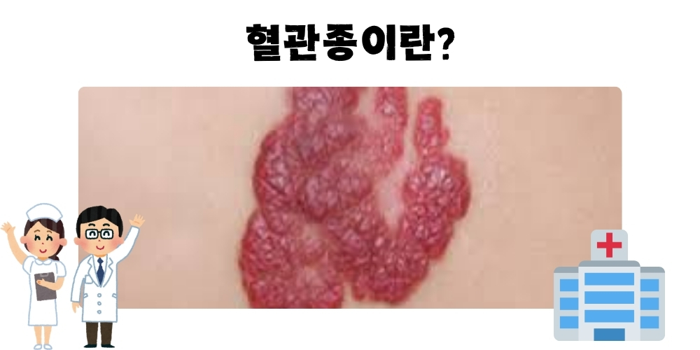 혈관종1