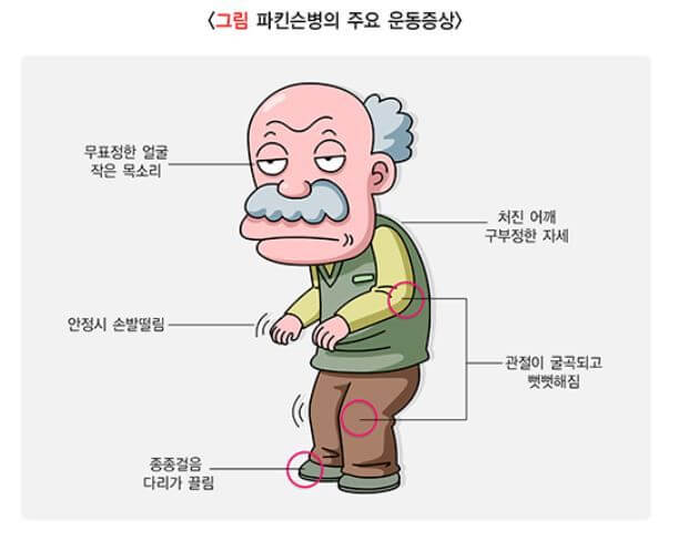 파킨슨병 증상