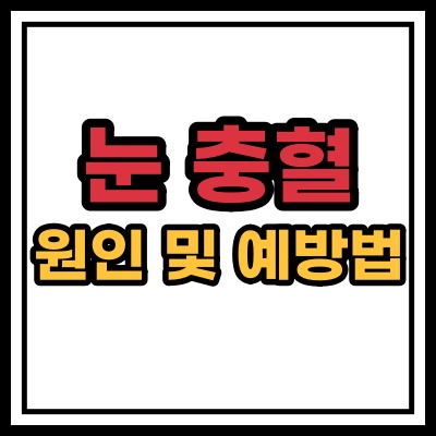  눈 충혈의 원인 예방