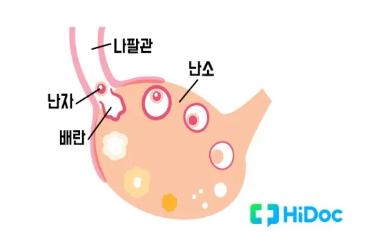 배란통 증상 및 시기 원인_5