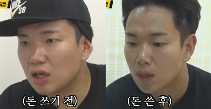 마곡동 슈링크 유니버스 동안 페이스 피부과 최신 리프팅 (+효과, 부작용, 가격정보) 3