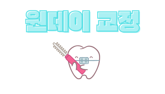 원데이 치과 교정 가격과 장단점