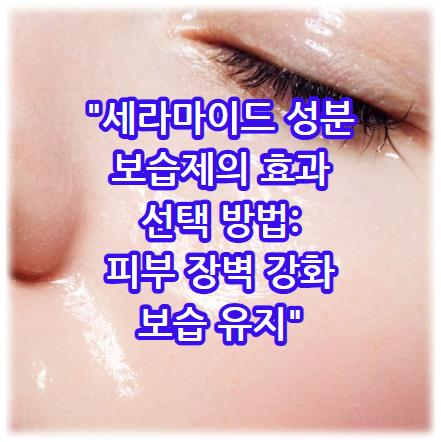 세라마이드 성분 보습제의 효과와 선택 방법: 피부 장벽 강화와 보습 유지