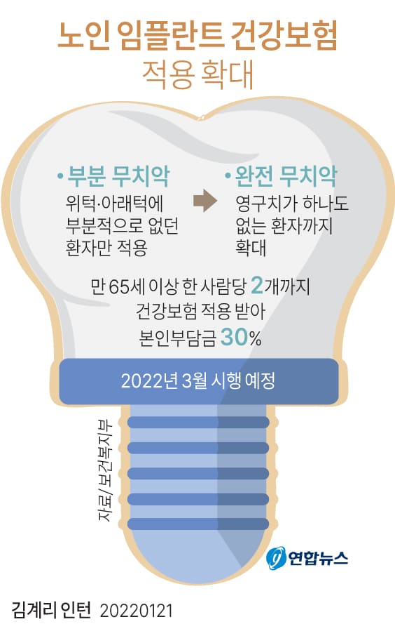  만 65세 이상 노인 임플란트 건강보험 적용 확대