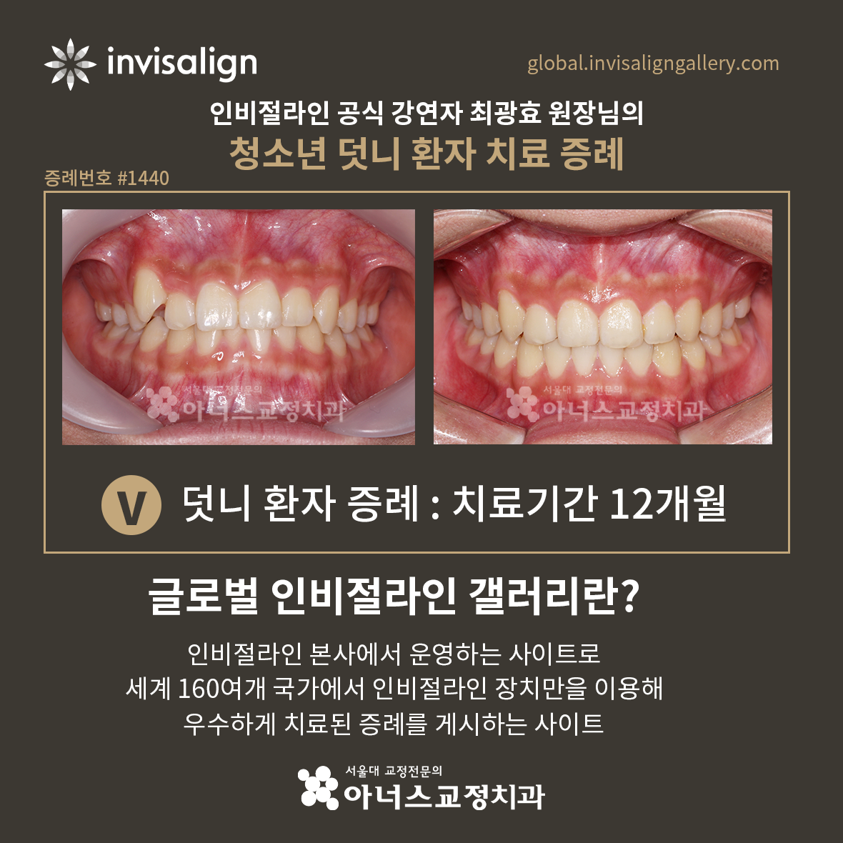 치아글로벌 이미지