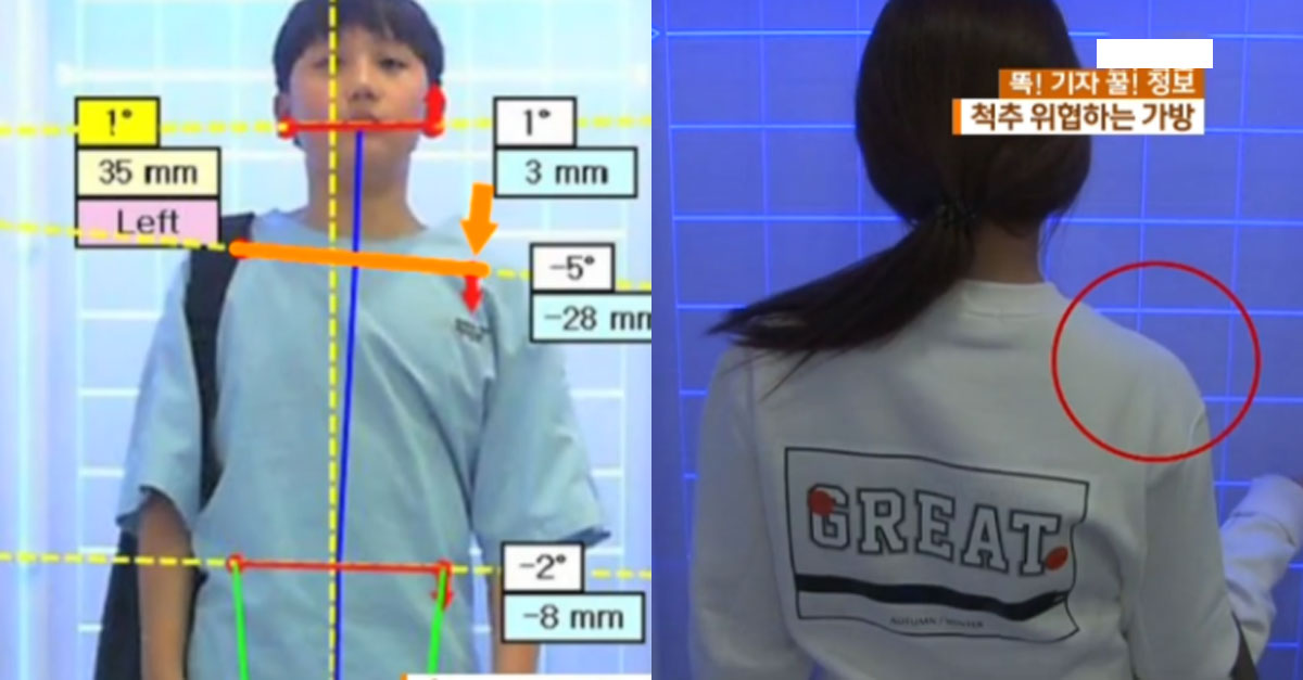  허리 건강 생각하면 절대 메면 안되는 가방