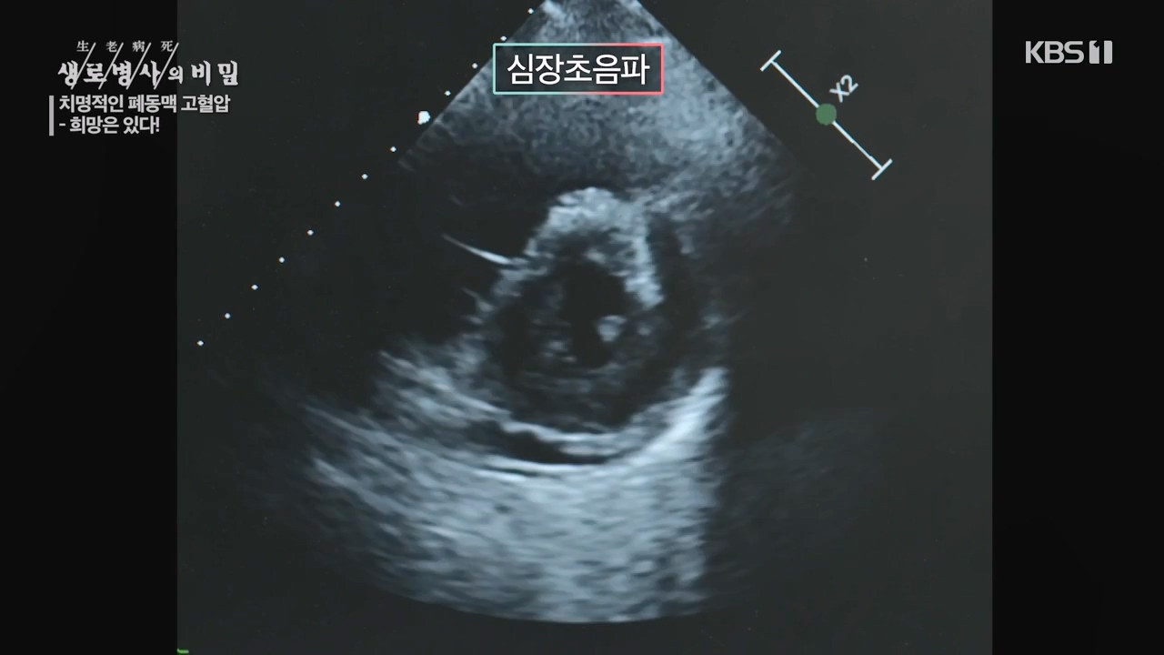 생로병사의 비밀.E900.240215p-NEXT.mp4_20240215_201742.726.jpg