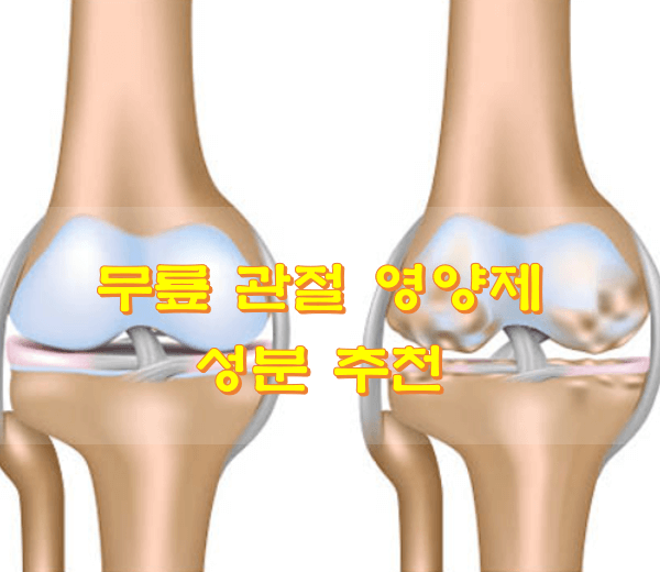  무릎 관절 영양제 성분 추천