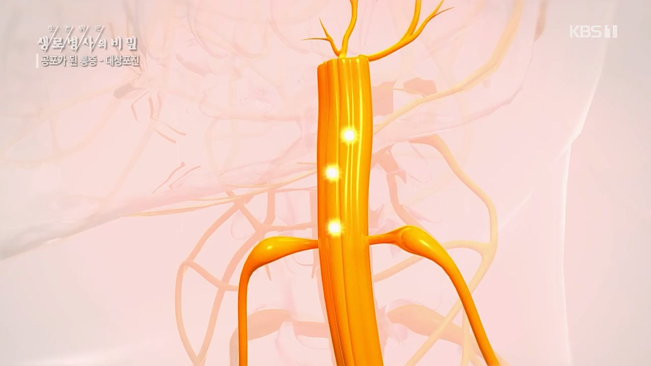 생로병사의 비밀.E857.230223p.H264-F1RST.mp4_20230223_202245.556.jpg