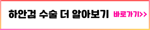 하안검 수술