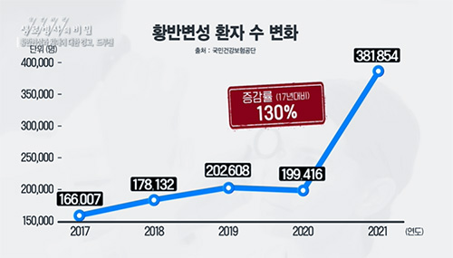 황반변성과 치매