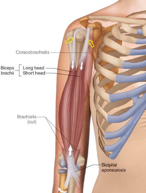 상완이두근의 장두와 단두를 구분해서 보여주고 있고 노란 화살표로 상완이두근 힘줄이 상완골머리를 누르는 것을 표현한 그림.