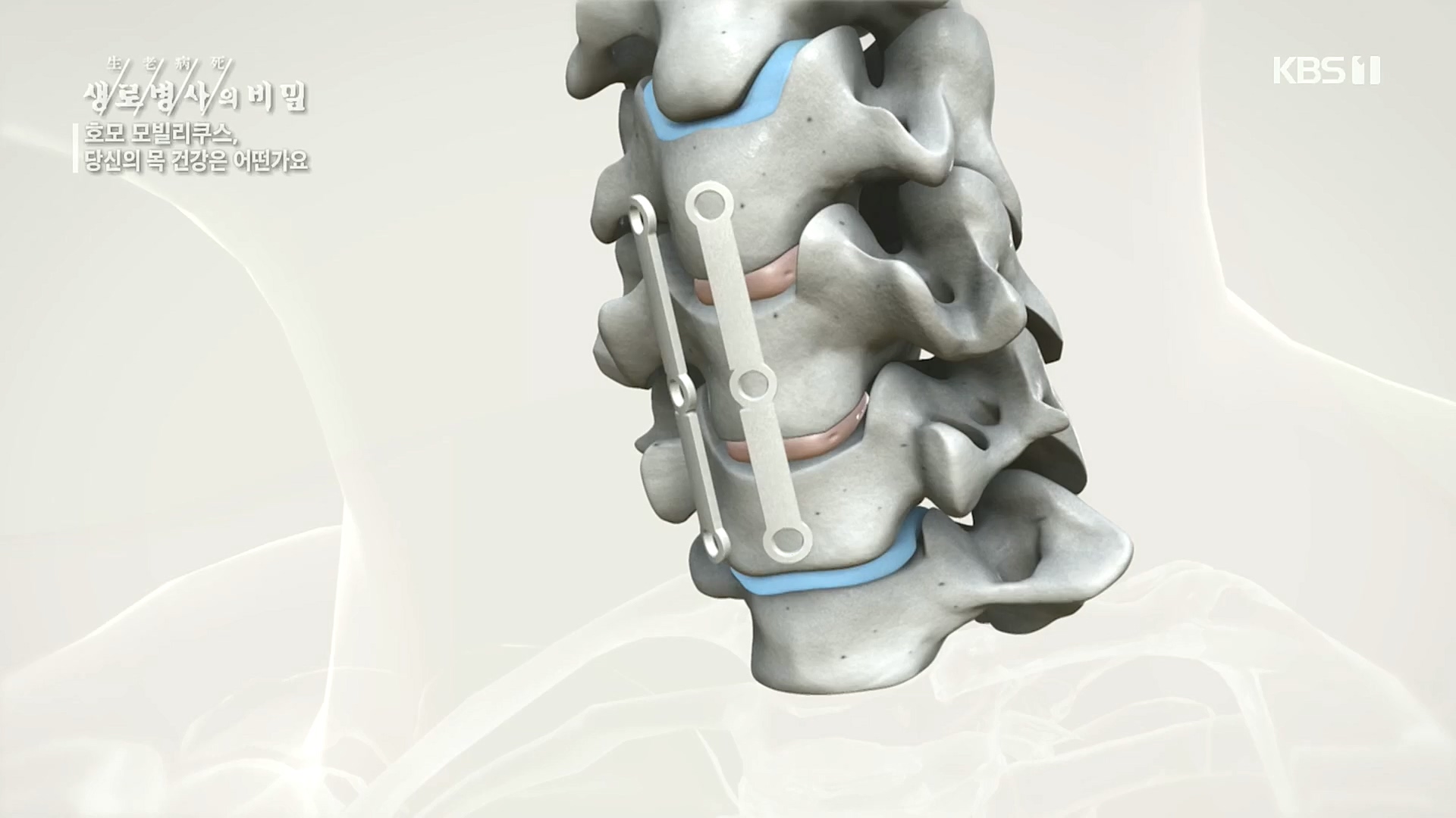 생로병사의 비밀.E841.221026p.H264-F1RST.mp4_20221027_200824.867.jpg