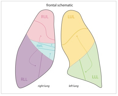 frontal view에서 무기폐의 fissrue의 이동