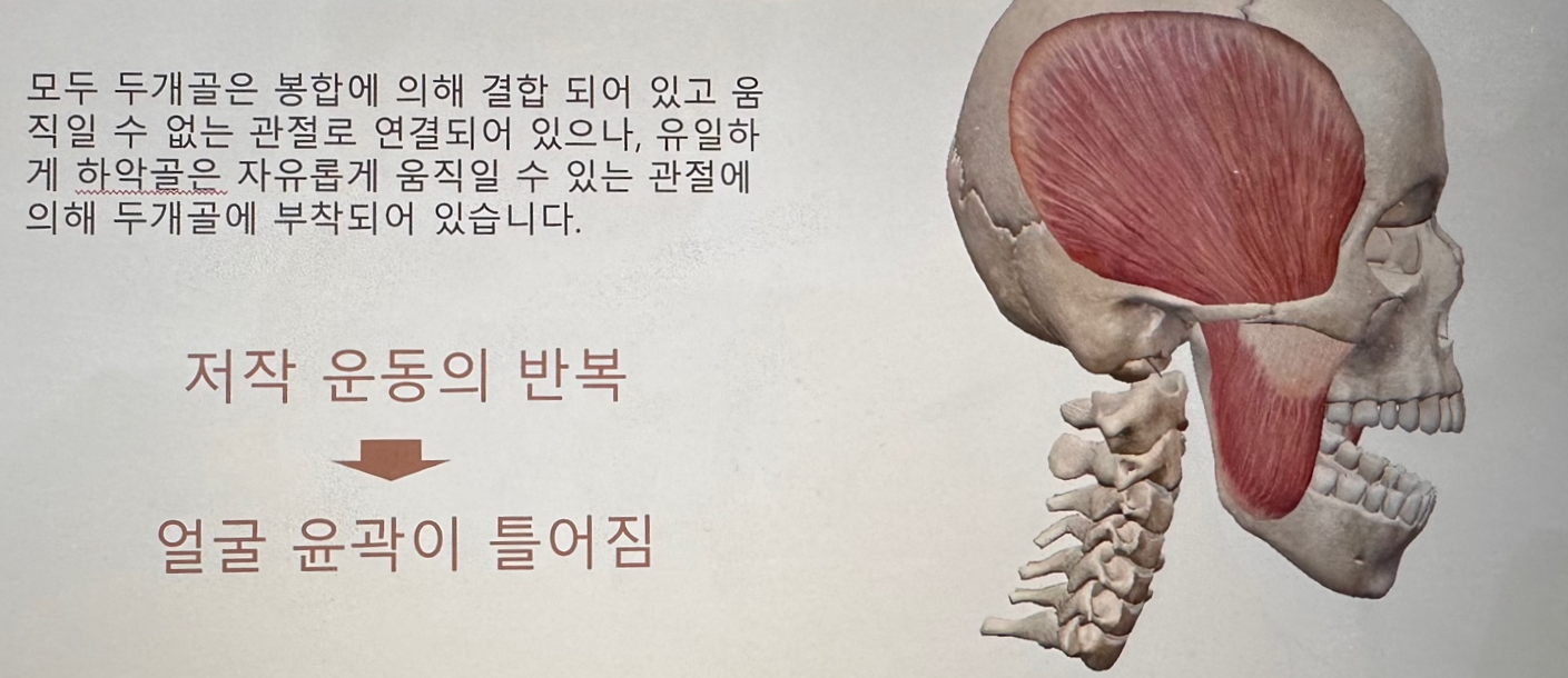 얼굴틀어짐 얼굴비대칭