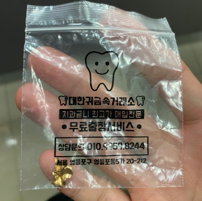  금니 빠졌을때... 종로 금니 팔기 치금 판매 후기