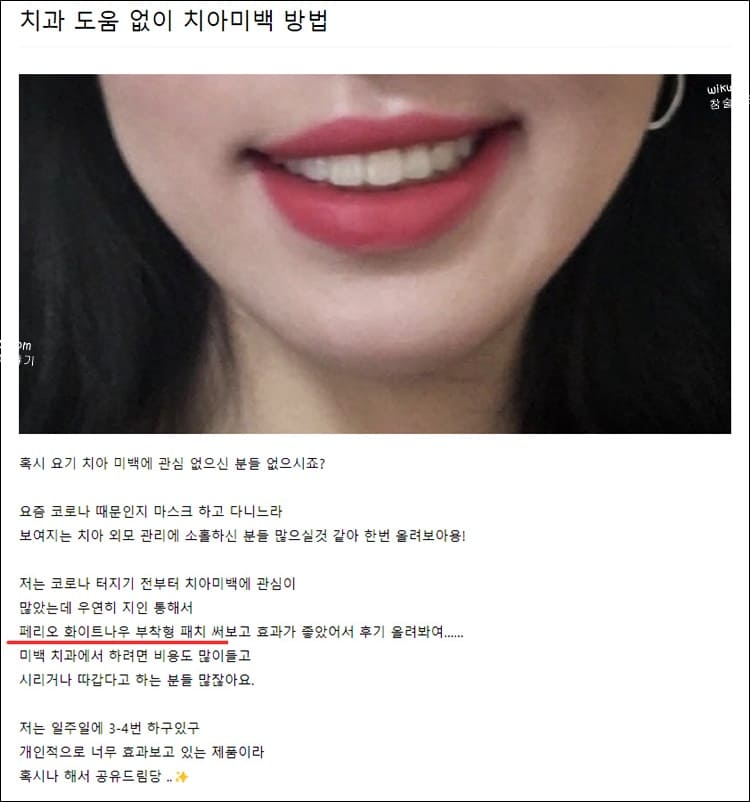 자가 미백 후기