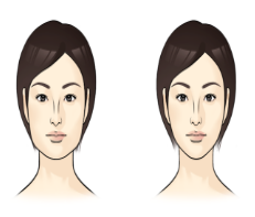  사각턱 보톡스 효과 및 추천 대상 알아보기