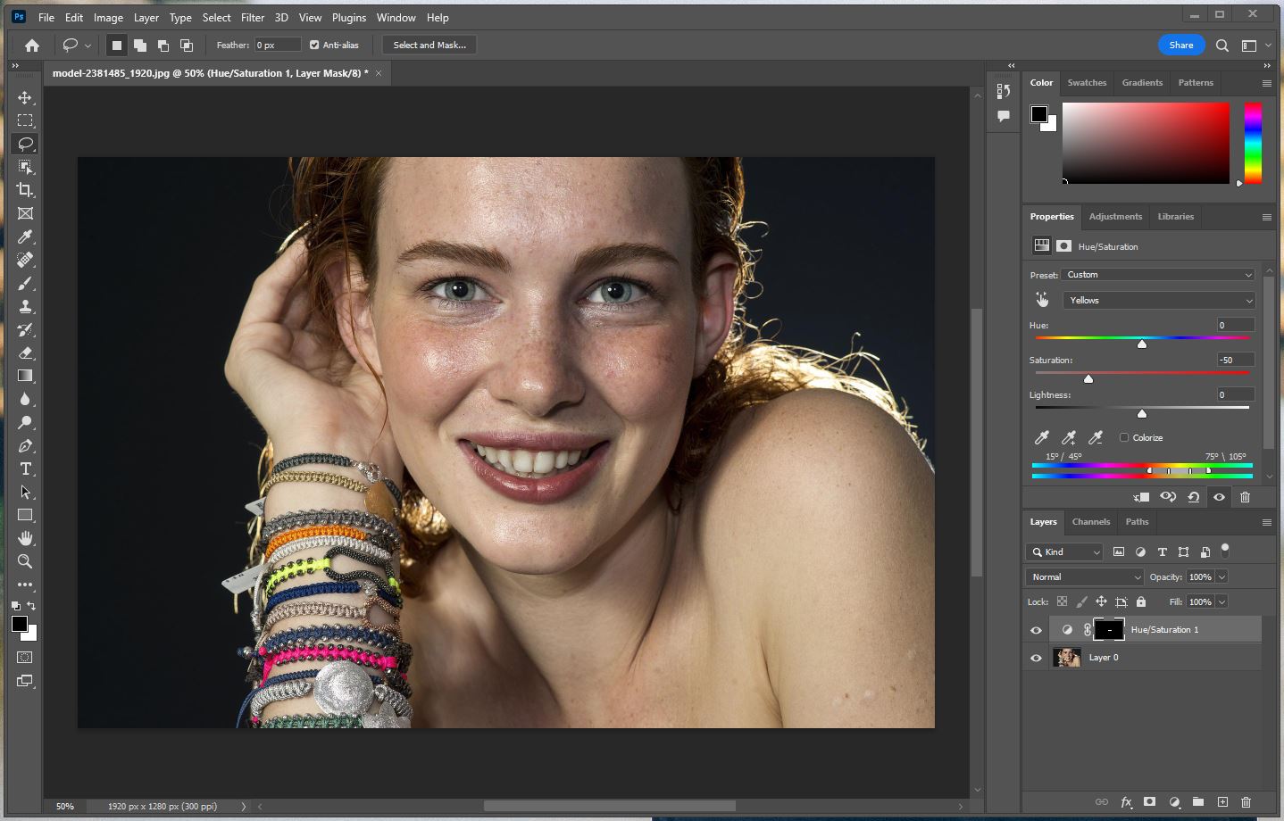 치아 채도 변경