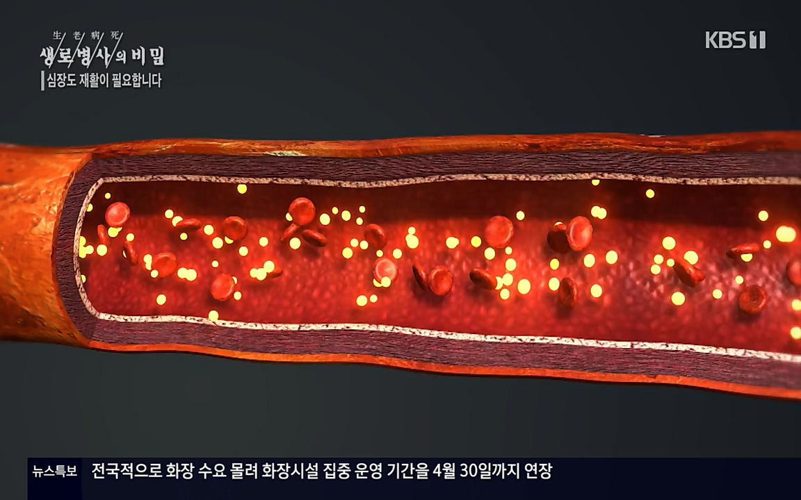 생로병사의 비밀.E820.220428p-NEXT.mp4_20220501_192735.602.jpg