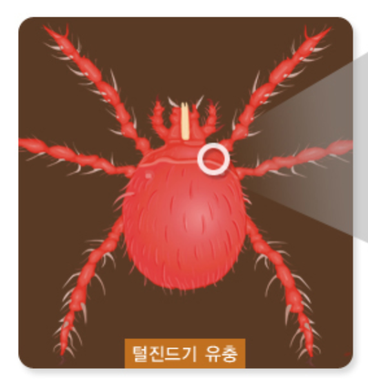  쯔쯔가무시병 원인 초기증상 합병증