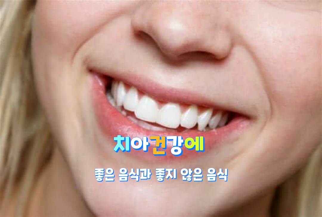  치아건강에 좋은 음식과 좋지 않은 음식 