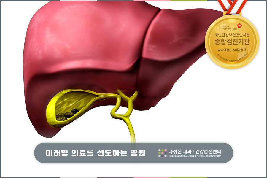 쓸개 담석 제거 방법 쓸개에 담석이 3
