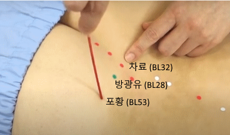 족태양방광경(BL) > BL53 포황 (胞肓) 1
