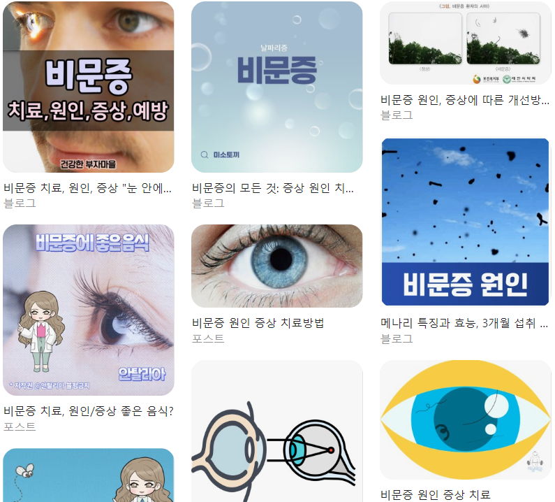  비문증 원인 증상 치료 총정리
