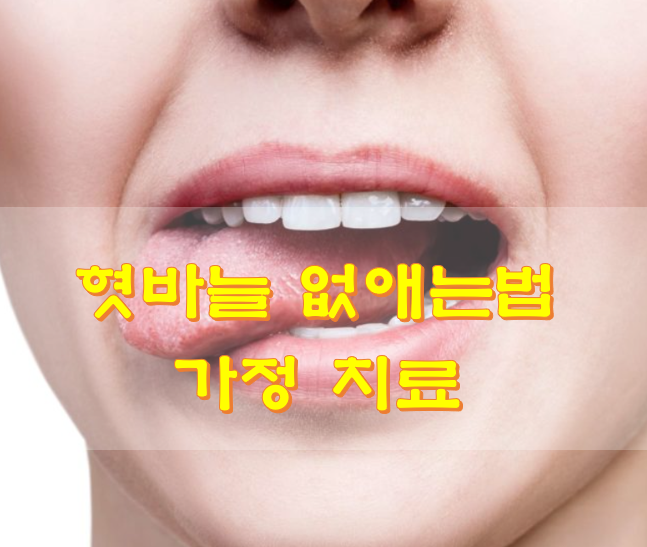  혓바늘 없애는법 가정 치료