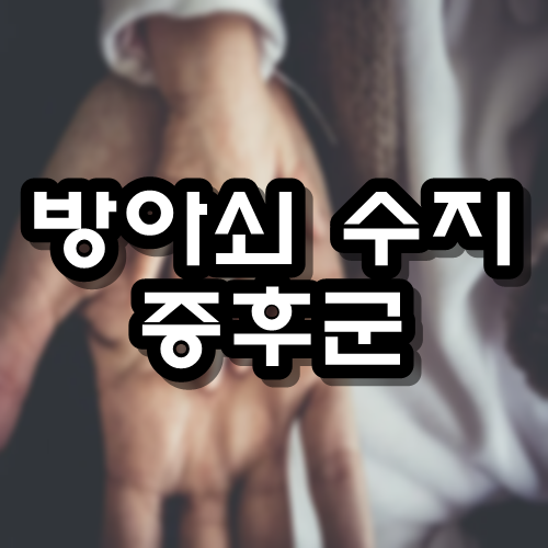  방아쇠 수지 증후군 원인 치료