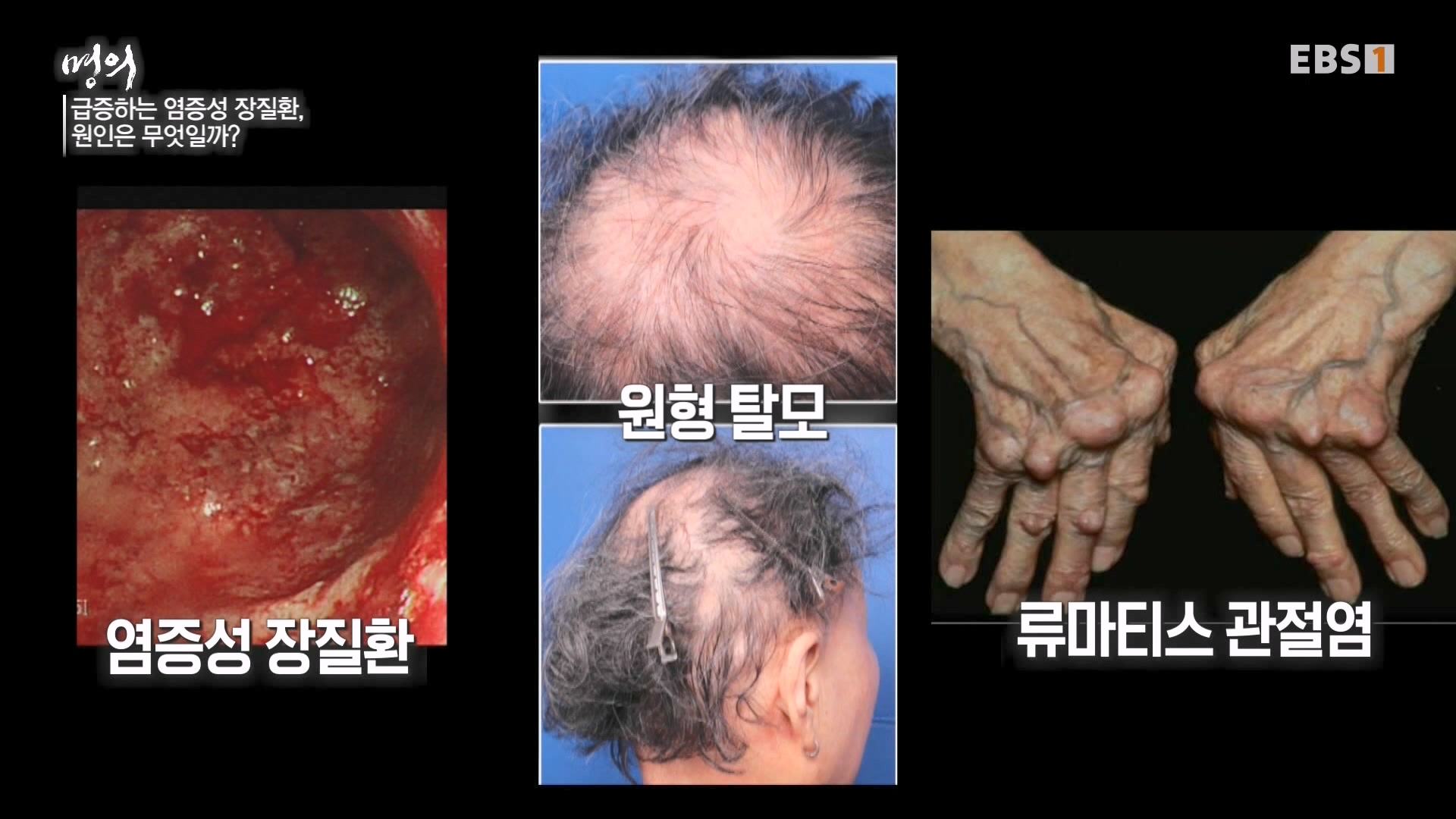 잘 먹고 잘 싸는 법 240323.mp4_20240324_174708.351.jpg