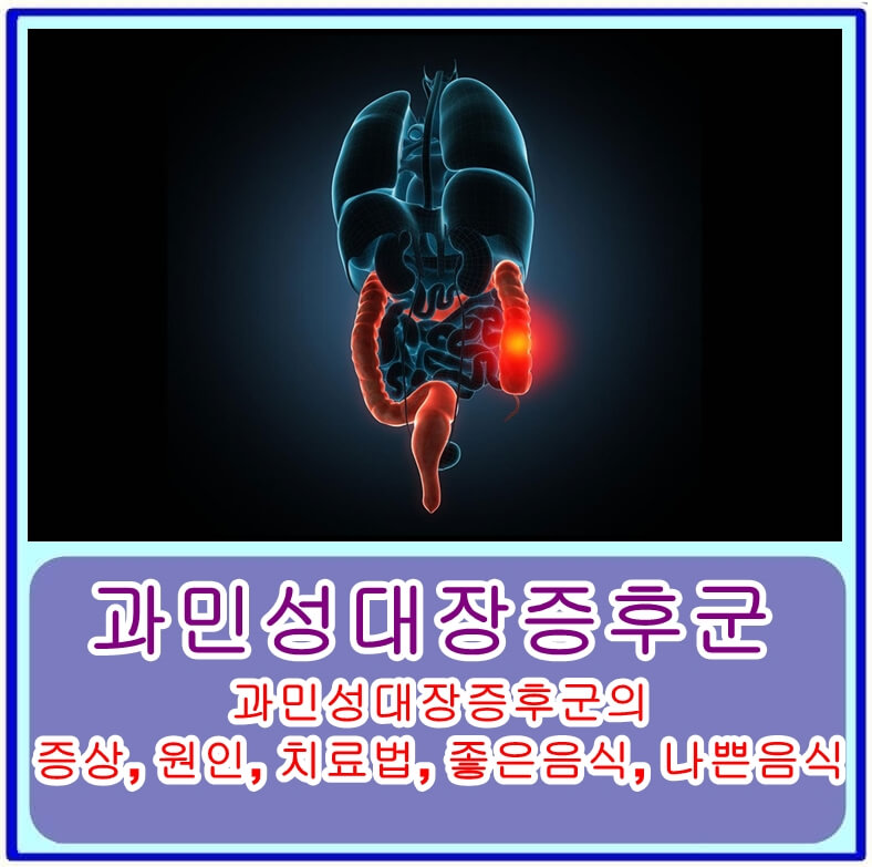  과민성대장증후군의 증상, 원인, 치료법, 좋은음식, 나쁜음식
