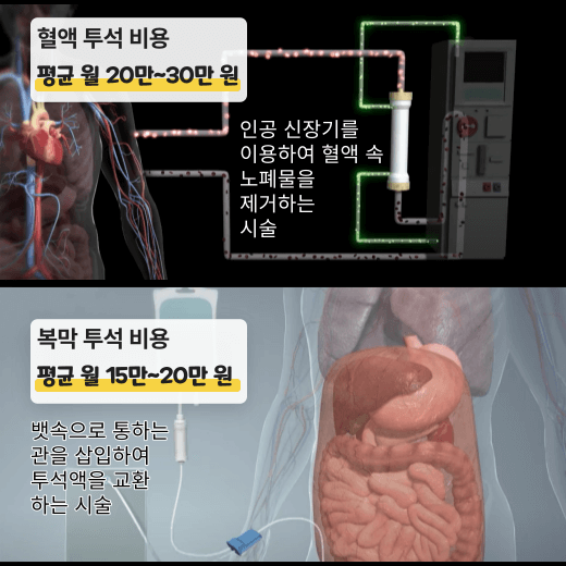 혈액-복막-투석-비용-비교