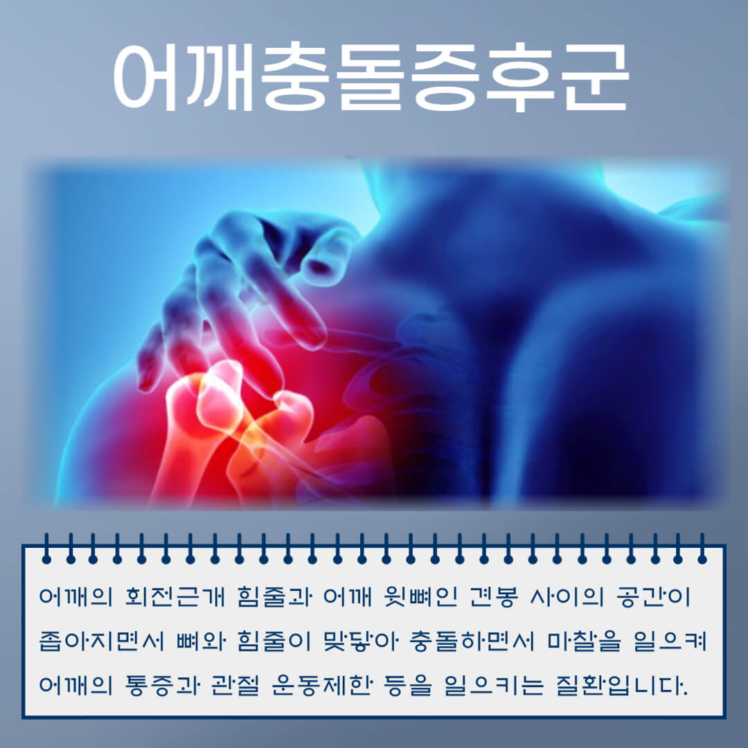 어깨충돌증후군