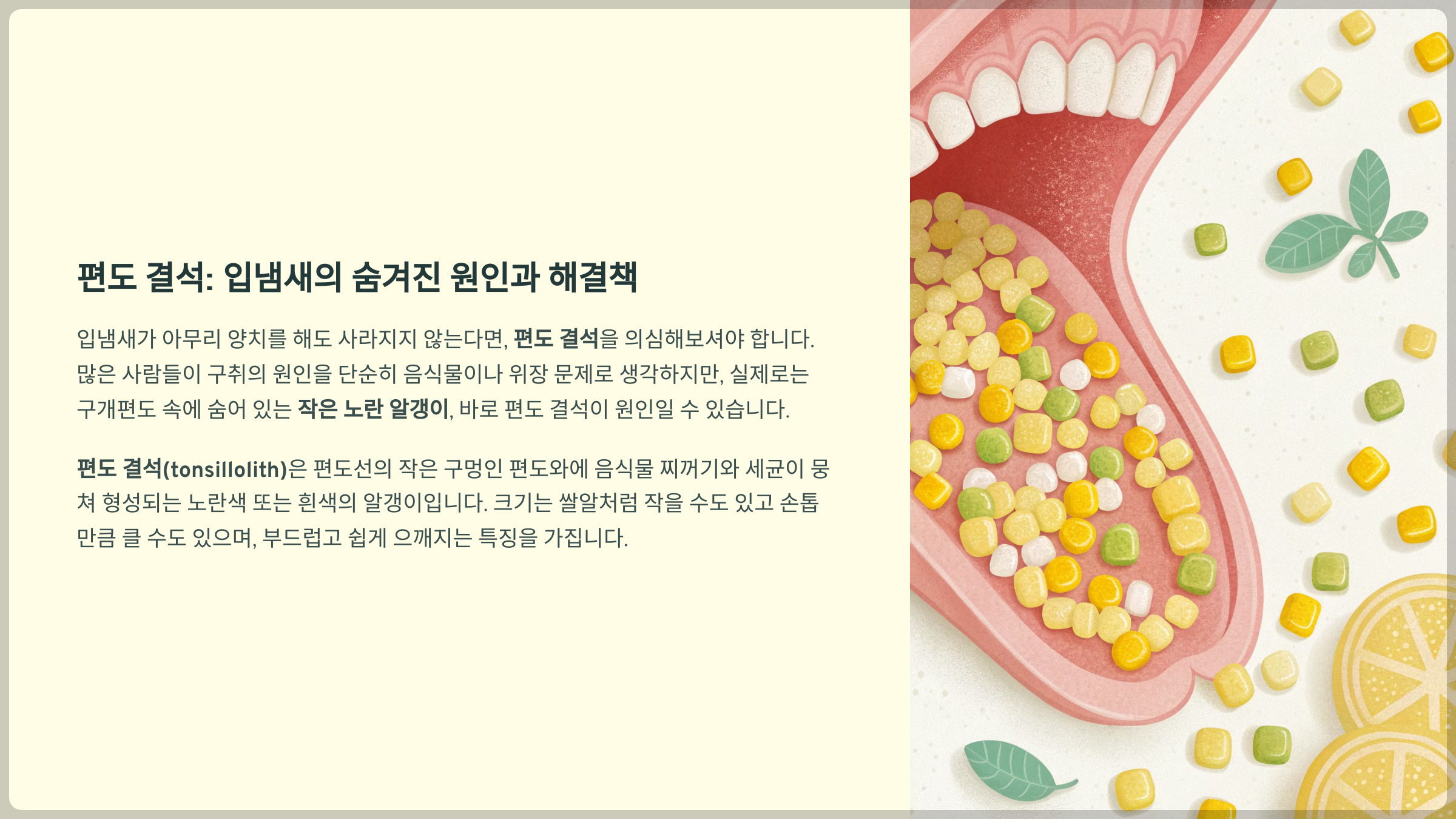 편도 결석(tonsillolith)