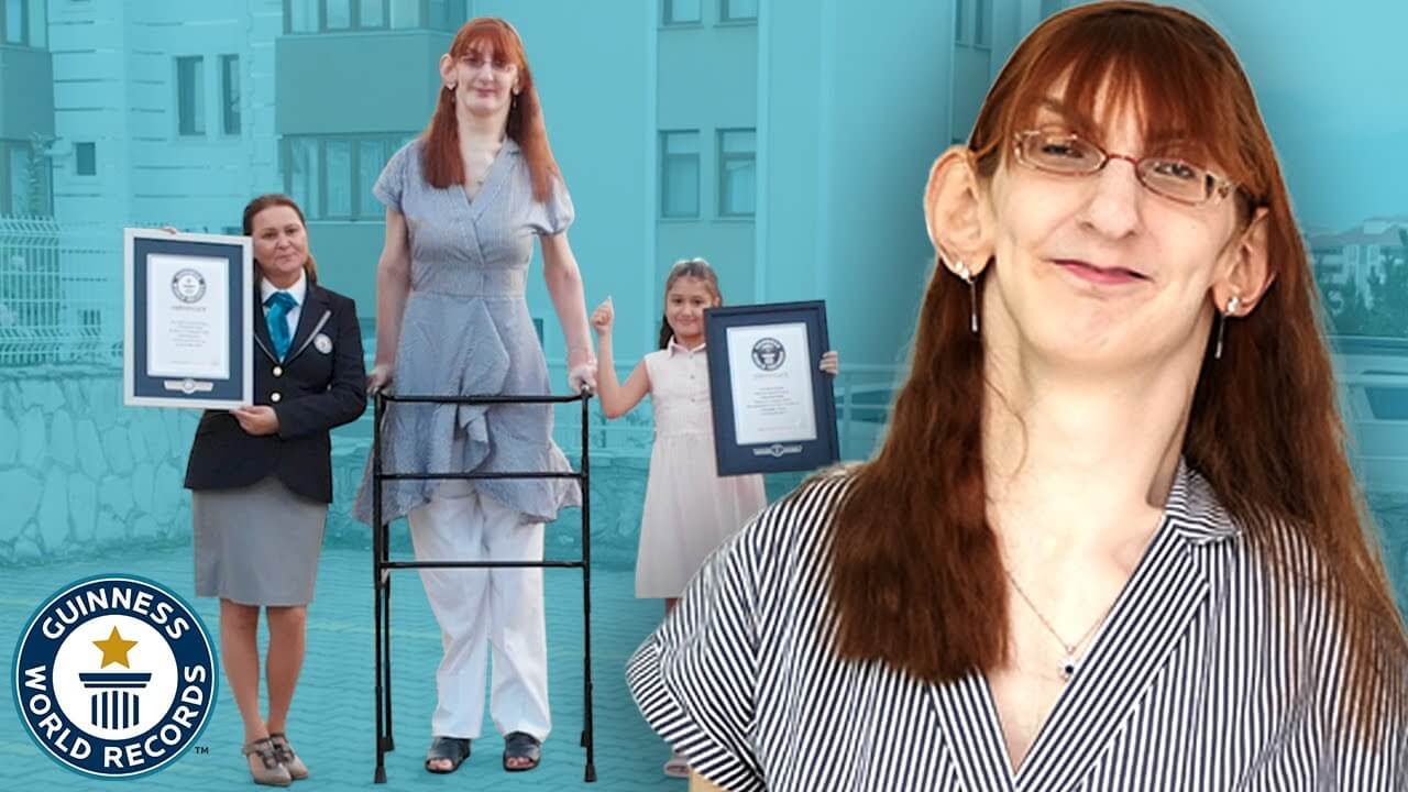 The world's tallest living woman is a 24-year-old from Turkey