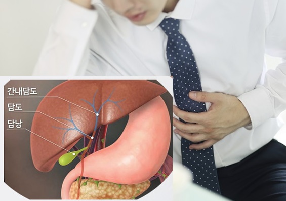  담도암 치료제 젬시타빈, 시스플라틴 그리고 아브락산이란?