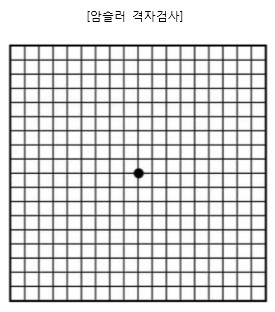  방치하면 실명할 수 있다는 눈 이상 증상 (feat. 암슬러 그리드 Amsier Grid)