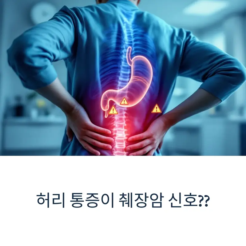 허리 통증을 호소하는 사람의 등 뒤에 췌장을 강조한 의료 일러스트, 췌장암 경고를 나타냄